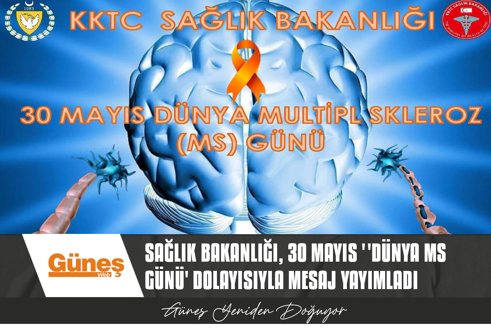 MULTİPL SKLEROZ NEDİR?