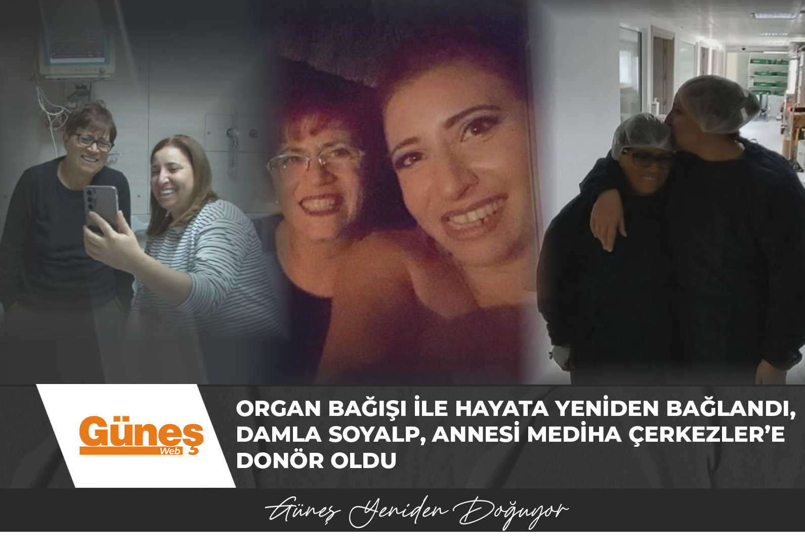 Organ bağışı ile hayata yeniden bağlandı….Damla Soyalp, Annesi Mediha Çerkezler’e donör oldu