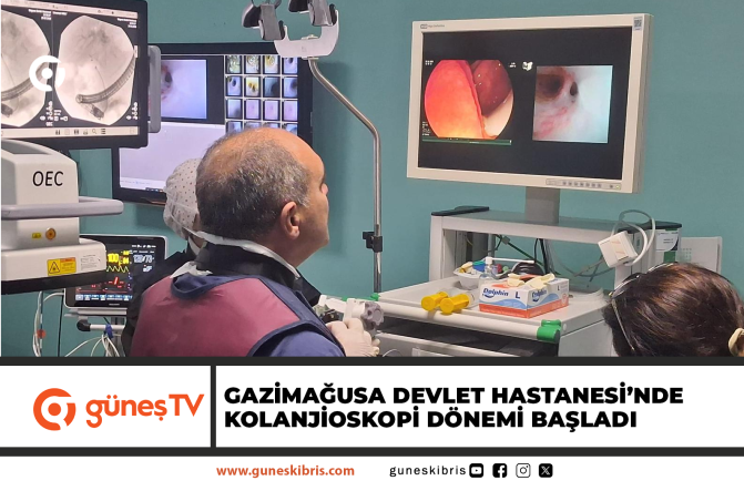 Gazimağusa Devlet Hastanesi’nde Kolanjioskopi Dönemi Başladı